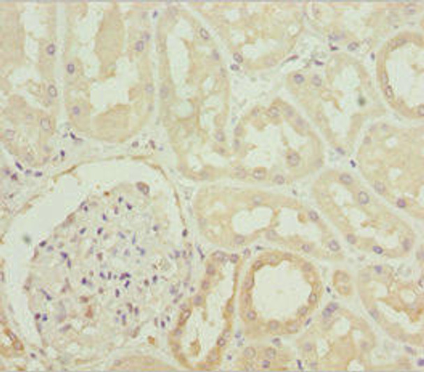 PLCD4 Antibody (PACO45032)