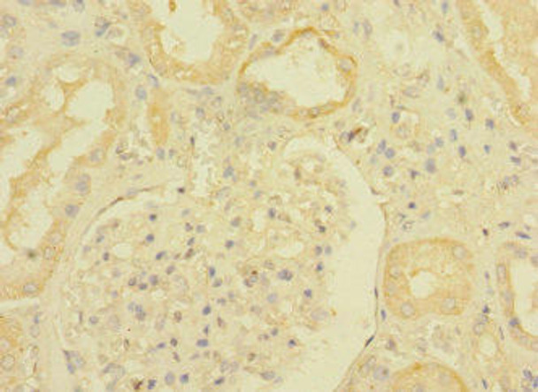 TGFBR3 Antibody (PACO45488)