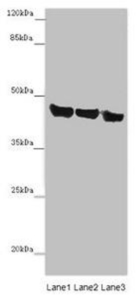 ASPN Antibody (PACO45682)