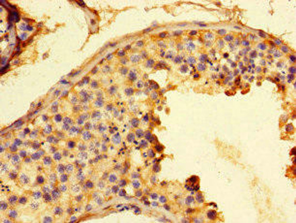 G6PD Antibody (PACO45846)