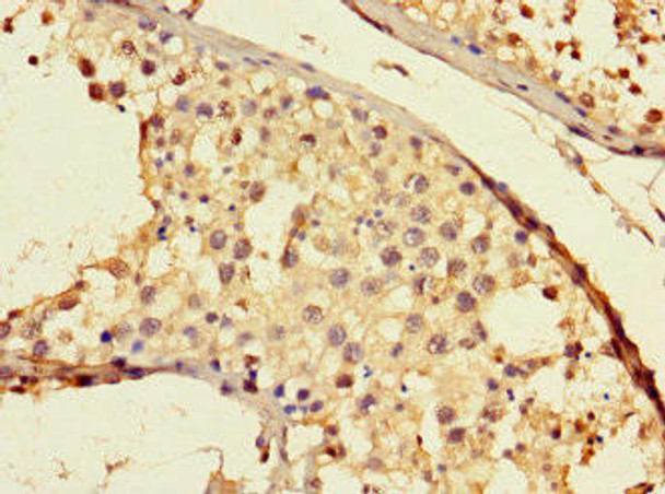 THADA Antibody (PACO46682)