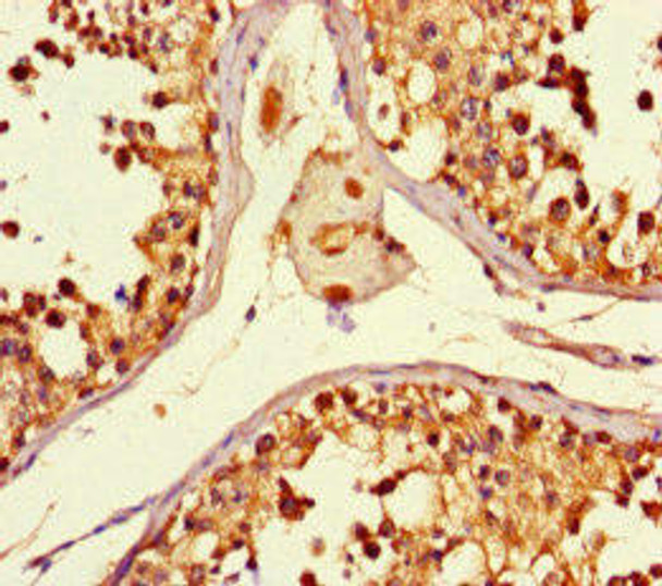 SMYD2 Antibody (PACO47198)