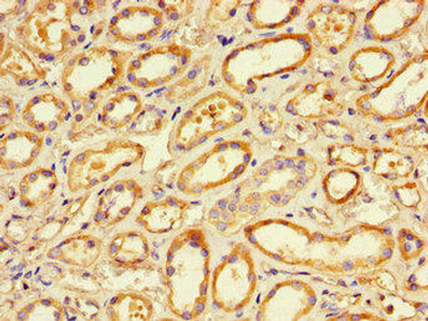 PRKCA Antibody (PACO47826)