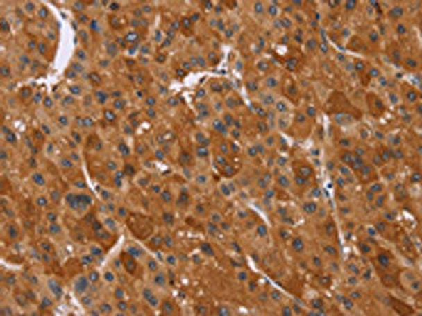 CTNNBL1 Antibody (PACO16087)
