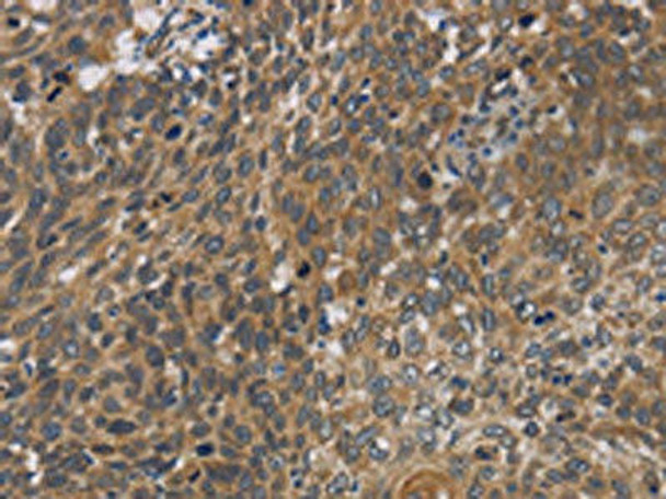 CYB5A Antibody (PACO16130)