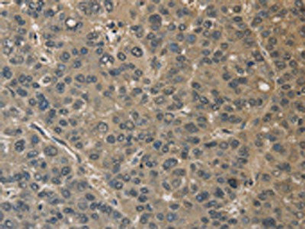 DRG1 Antibody (PACO16202)