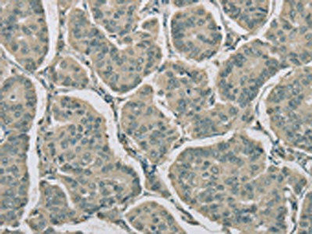 RNASE3 Antibody (PACO16223)