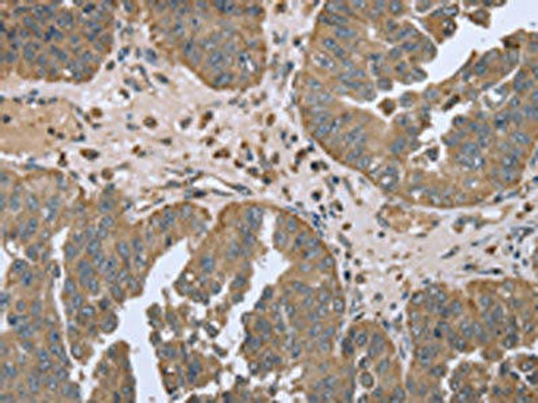 FANCG Antibody (PACO16310)