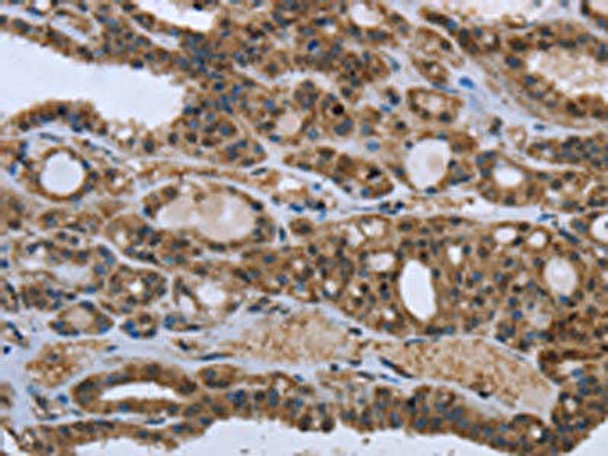 GGCX Antibody (PACO16407)