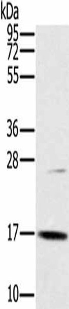 OCIAD2 Antibody (PACO16810)