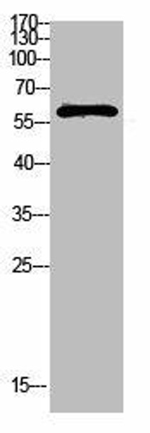 FBXO7 Antibody (PACO07458)