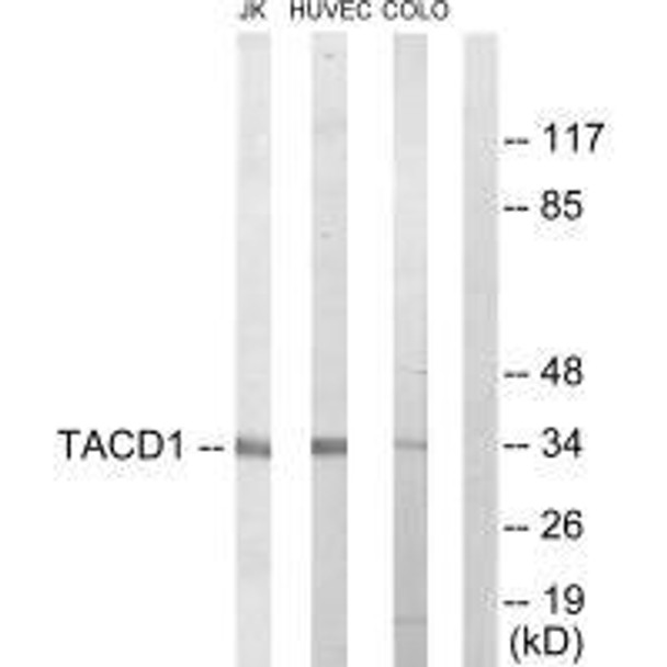 EPCAM Antibody (PACO21734)