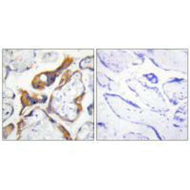 PHLDA2 Antibody (PACO21873)