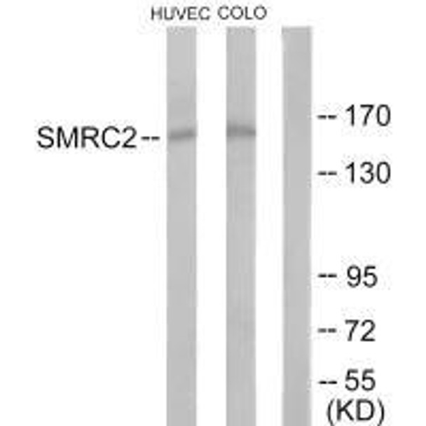 SMARCC2 Antibody (PACO21904)