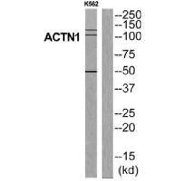 ACTN1 Antibody (PACO22007)