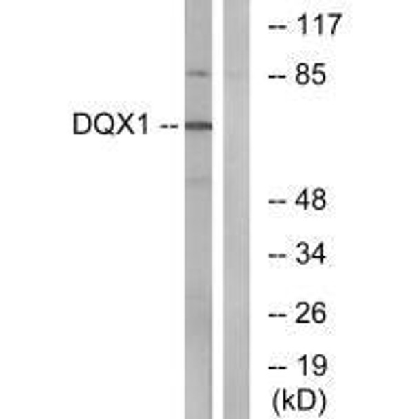 DQX1 Antibody (PACO22182)