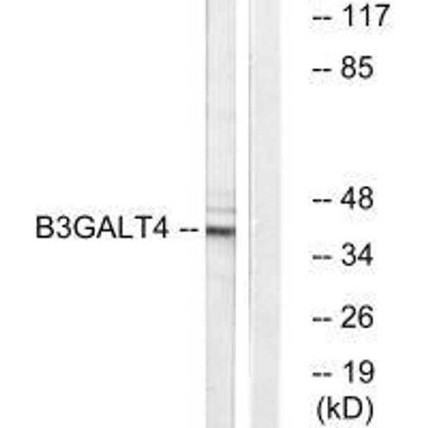 B3GALT4 Antibody (PACO22195)
