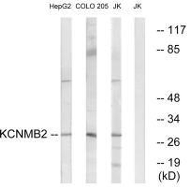 KCNMB2 Antibody (PACO22214)