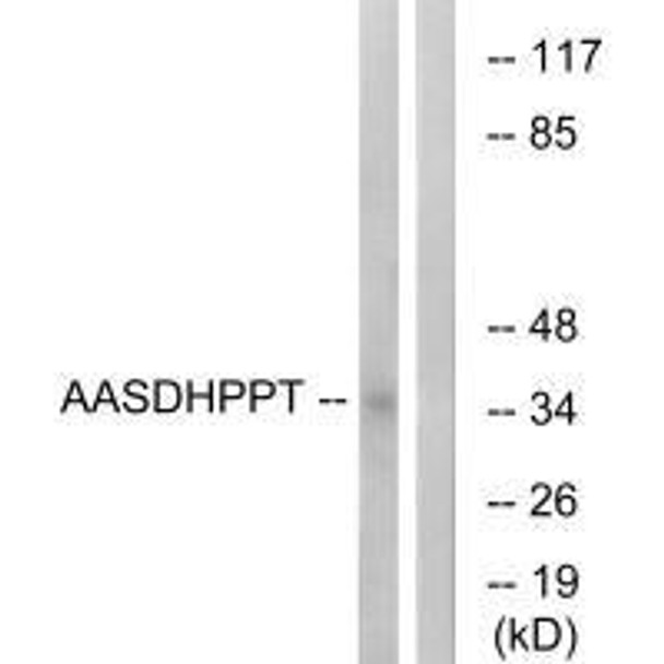 AASDHPPT Antibody (PACO22384)