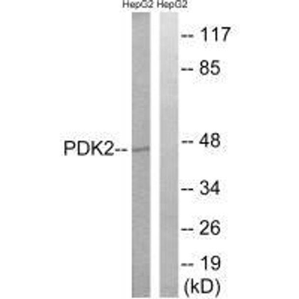 PDK2 Antibody (PACO22535)