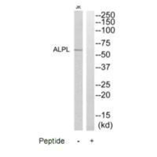 ALPL Antibody (PACO22760)