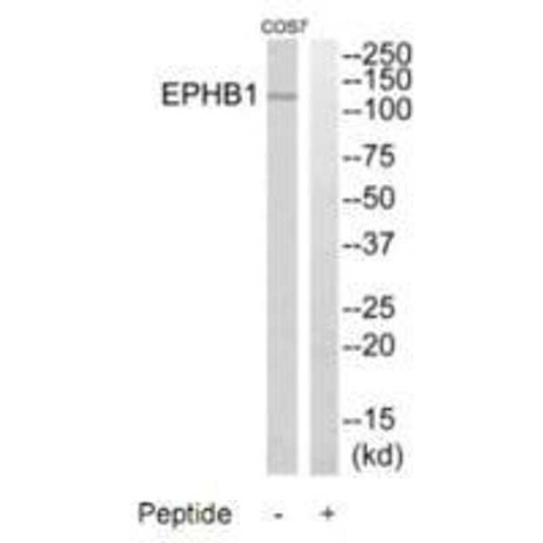 EPHB1 Antibody (PACO22797)