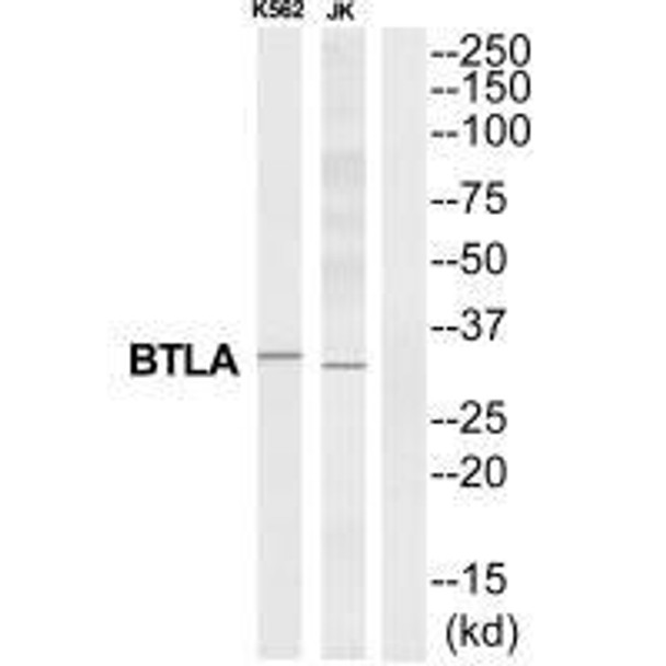 BTLA Antibody (PACO22820)