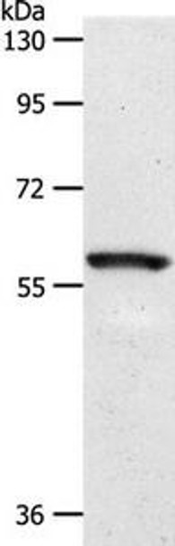 SLC5A1 Antibody (PACO22850)