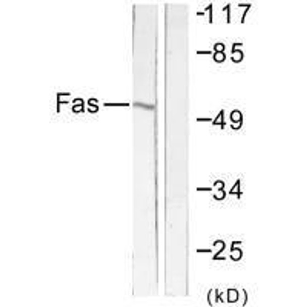 FAS Antibody (PACO23142)