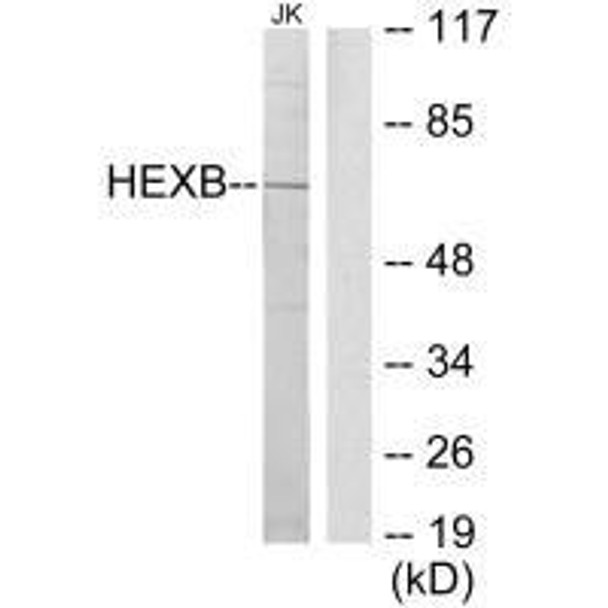 HEXB Antibody (PACO23191)