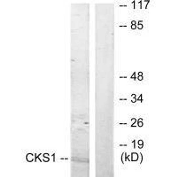 CKS1B Antibody (PACO23237)