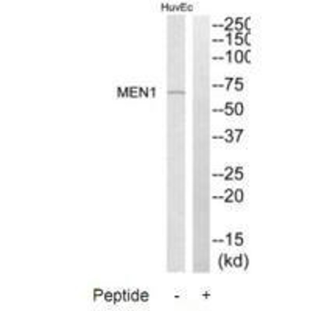 MEN1 Antibody (PACO23344)