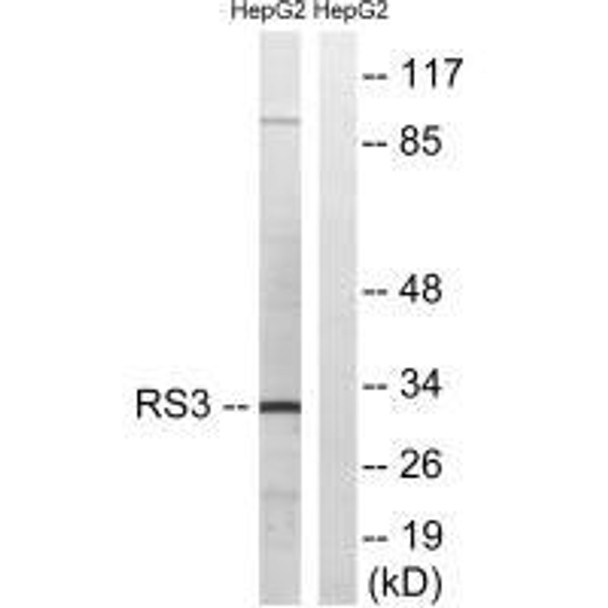 RPS3 Antibody (PACO23361)