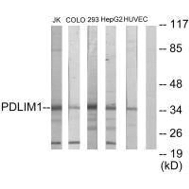 PDLIM1 Antibody (PACO23719)