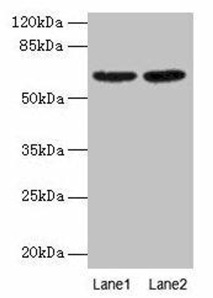 NELFB Antibody (PACO31744)