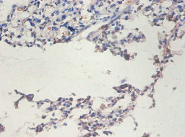 TERT Antibody (PACO32884)