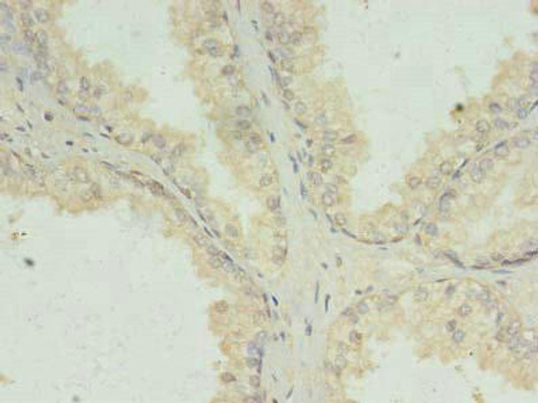 PRKRA Antibody (PACO33364)