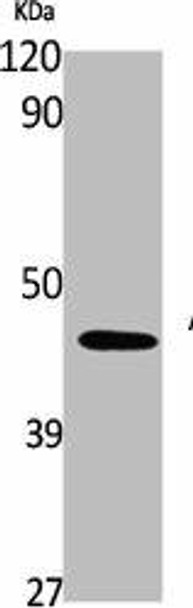 SERPINA1 Antibody (PACO01775)