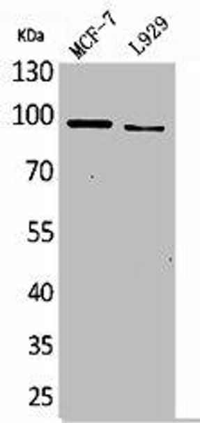 SEMA4D Antibody (PACO01964)