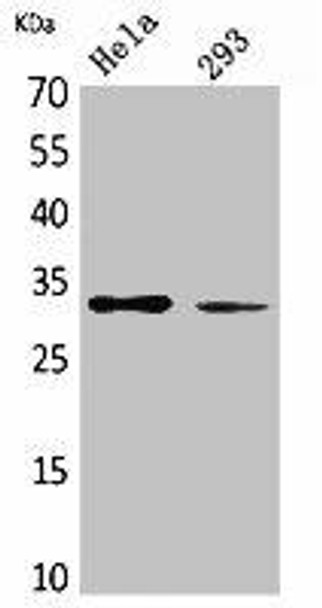SDHB Antibody (PACO02126)