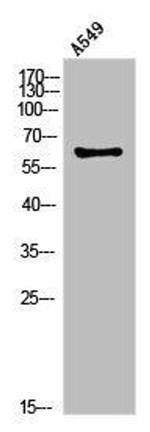 PLAT Antibody (PACO02975)