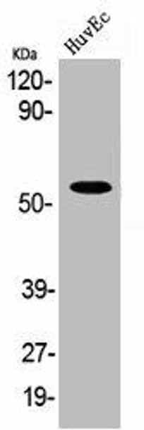 ABI1 Antibody (PACO06220)