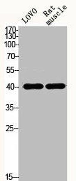 ACTA1 Antibody (PACO06228)