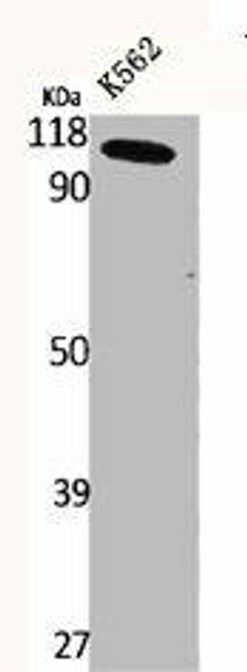 CLCN6 Antibody (PACO06355)