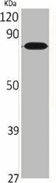 CNGA2 Antibody (PACO06364)