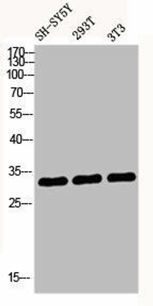 KCNIP3 Antibody (PACO06436)