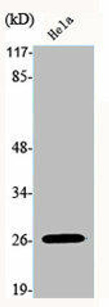 HOXB9 Antibody (PACO06561)