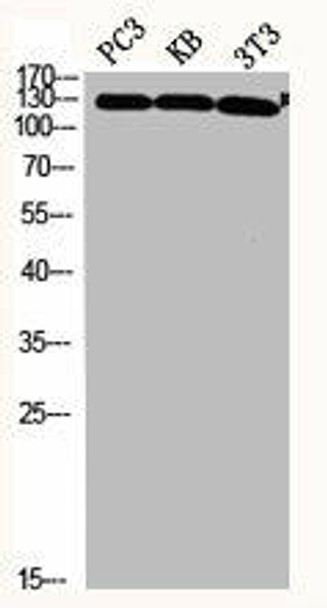 JAK2 Antibody (PACO06595)