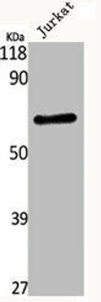 KCNC4 Antibody (PACO06608)