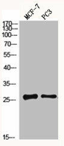MGMT Antibody (PACO06641)